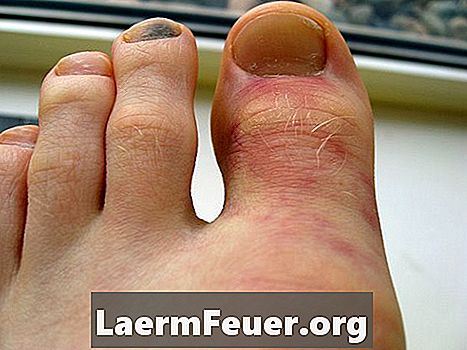 Vad är orsakerna till smärta i fingrarna i händer och fötter?