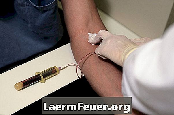 איזה סוג של בדיקת דם נעשה במקרה של שחמת הכבד?