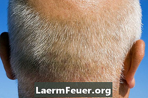 Kādus vitamīnus lieto vīrietis ar matu izkrišanu?