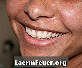Homöopathische Heilmittel für Zahnfleisch