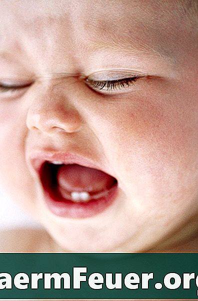 Remedios para aliviar el dolor en las encías de los bebés