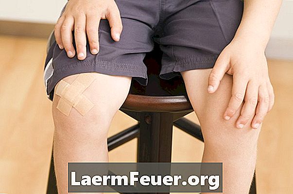 Remedii pentru durerea genunchiului