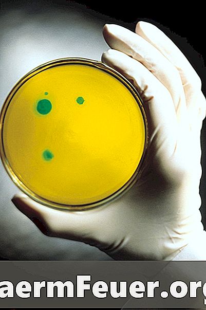 Ομοιότητες μεταξύ των βακτηριδίων και των προβστηρίων