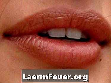 口内ブドウ球菌感染症の症状