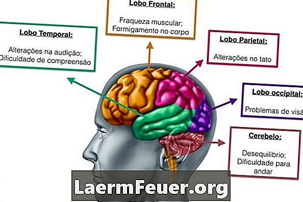 Symtom på cerebellär tumör