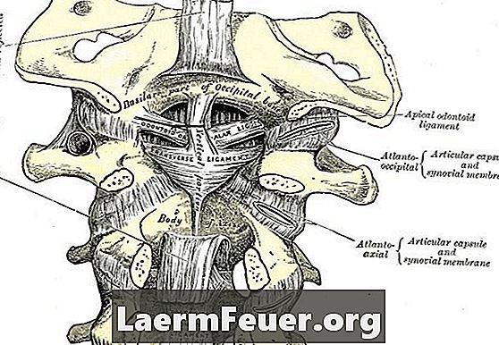 תסמונת פנים צוואר הרחם של neuralgia אוקסיפיטלית