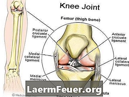 Rawatan displasia lutut