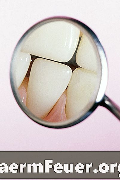 Zdravljenje parodontalne bolezni z antibiotiki