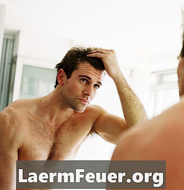 Nedskärningar och tricks för att förklara håravfall hos män