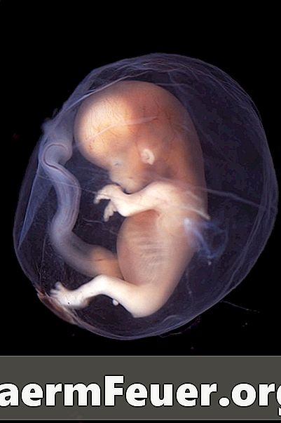Um ultrassom lhe dá a idade do feto ou da gestação?