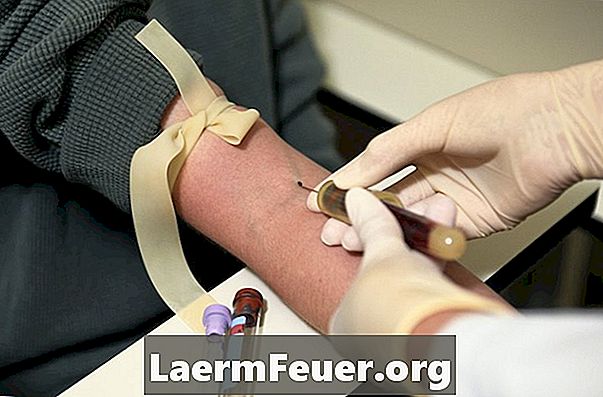 Normaler mittlerer Blutplättchenwert bei einem Bluttest