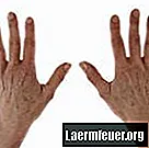 Operatie van het ligament van de vingers
