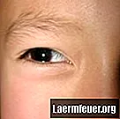 Ursachen für Haarausfall durch Augenbrauen