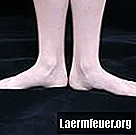 Kako osvetliti zatemnjene nohte na nogah
