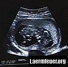 Bagaimana membandingkan jantina bayi dalam gambar ultrasound