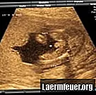 Kako ugotoviti spol otroka na ultrazvoku