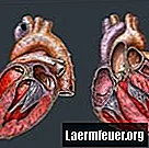 Was ist moderate Kardiomegalie?