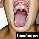Що викликає гіркий присмак у роті