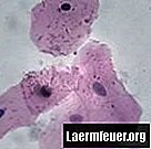Шта су сквамозне епителне ћелије?