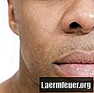 Jaká je příčina baňatého nosu?