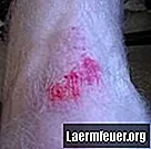 Hur lång tid tar det att läka ett skinnat knä?